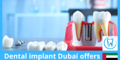 Dental implant Dubai offers by Clinic – Up to 60% Off